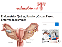 Tablet Screenshot of endometrio.net